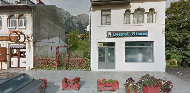 Dental Stone - Dentist